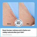 Smoothing Solution Ingrown Hair Treatment